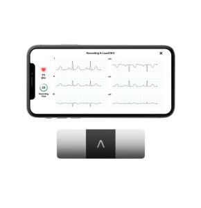 AliveCor KardiaMobile 6L | Le Moniteur ECG Personnel connecté à 6 dérivations. Détectez la Fibrillation auriculaire en Seulement 30 Secondes - ...