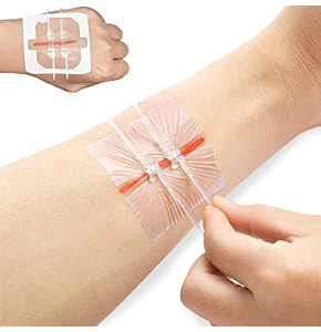 Band-aid à glissière, bandages de liaison en tissu élastique, fermetures de lacération d'urgence sans suture Dispositif de fermeture de plaie P...