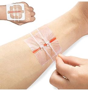 Zipper Bandages for Needleless Emergency Laceration Closure