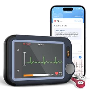 CheckMe Moniteur ECG Portable Professionnel avec Écran Tactile et Analyse par IA