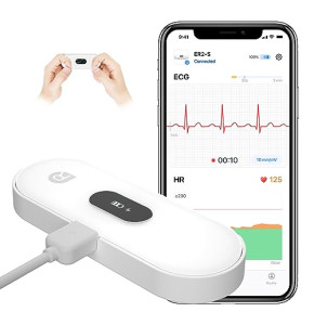 CheckMe DuoEK-S ECG Portable Professionnel avec Écran OLED, Electrocardiogramme ECG Bluetooth avec APP pour iOS et Android, Surveillance 30s - 5 m...