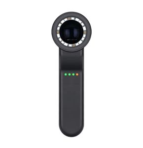 Durratou Le Dermatoscope Portable Professionnel DE-4100 Advance Connecte un Appareil Photo avec Widget Mobile