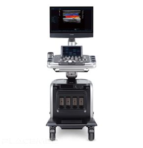 E-CUBE 15 Platinum Ultrasound System