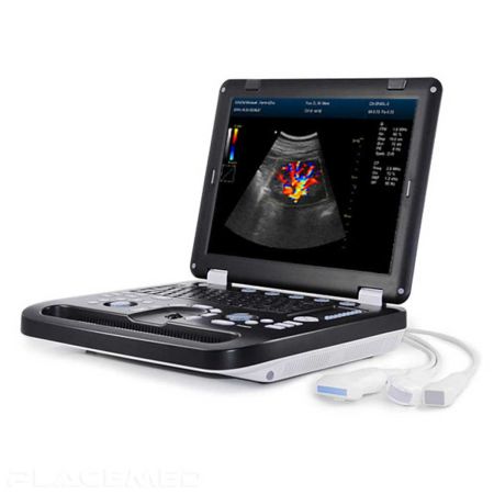 Color Doppler Ultrasound System  - DCU50